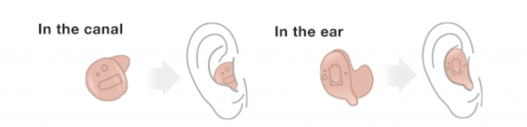 In the ear hearing aid