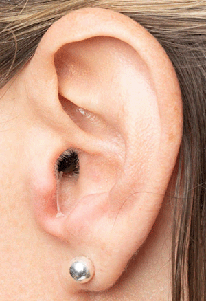 Eargo device inserted into ear canal